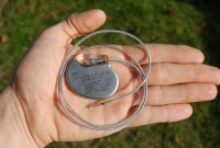 Hacker vaillant rien d'impossible : les pacemakers, cibles faciles pour des attaques ciblées ?