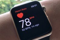 Troubles cardiaques : l'Apple Watch a officiellement aidé la médecine