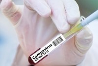 Dépistage du coronavirus : pourquoi les tests sérologiques sont-ils si importants ?