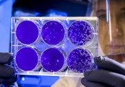 Tout comprendre aux mutations du coronavirus SARS-CoV-2 en 5 questions