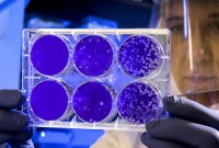 Tout comprendre aux mutations du coronavirus SARS-CoV-2 en 5 questions