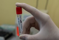 Après la fuite des résultats de 1,4 million de tests covid, l’AP-HP a bien...