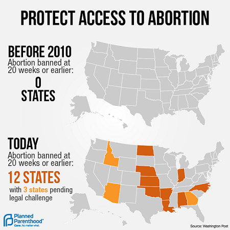 Aux États-Unis, le droit à l&rsquo;avortement recule